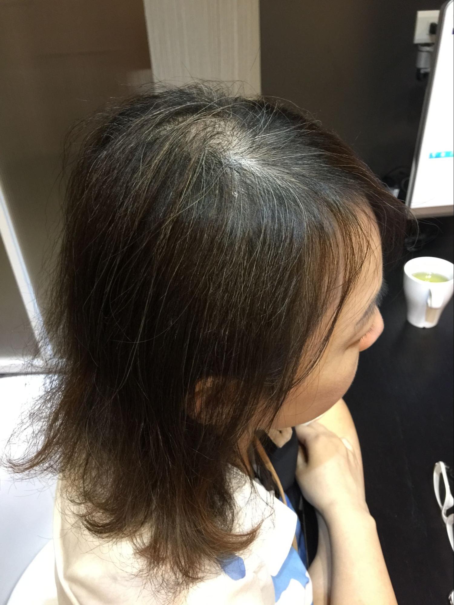 Dry Hair Loss | juliArt Dry Hair Loss | juliArt