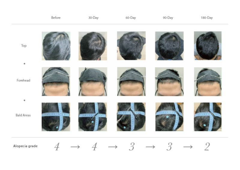juliArt IRB hair growth test result (1)