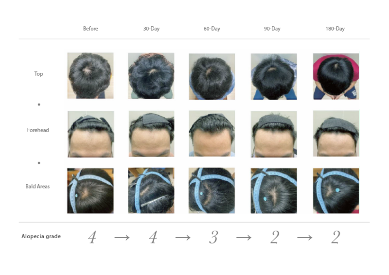 juliArt IRB hair growth test result (2)
