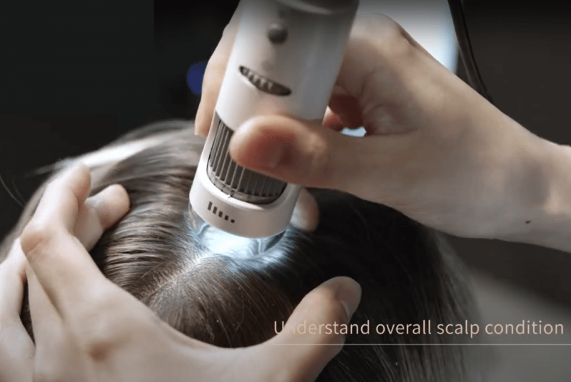 Juliart scalp care check