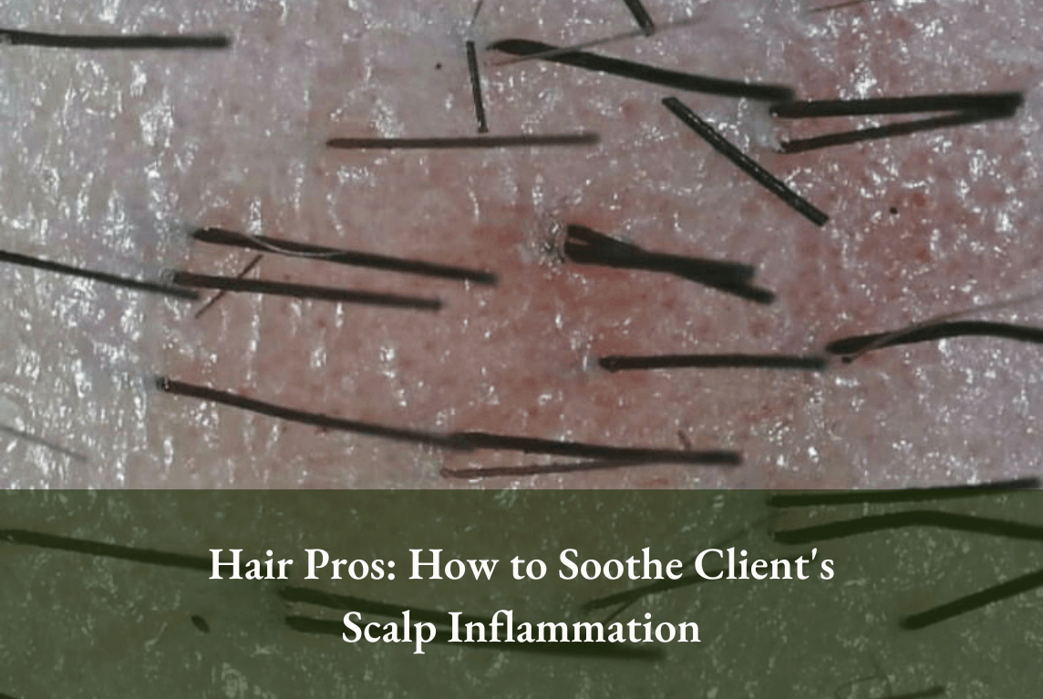 juliArt hairstylist must know_How to Soothe Client's Scalp Inflammation 2