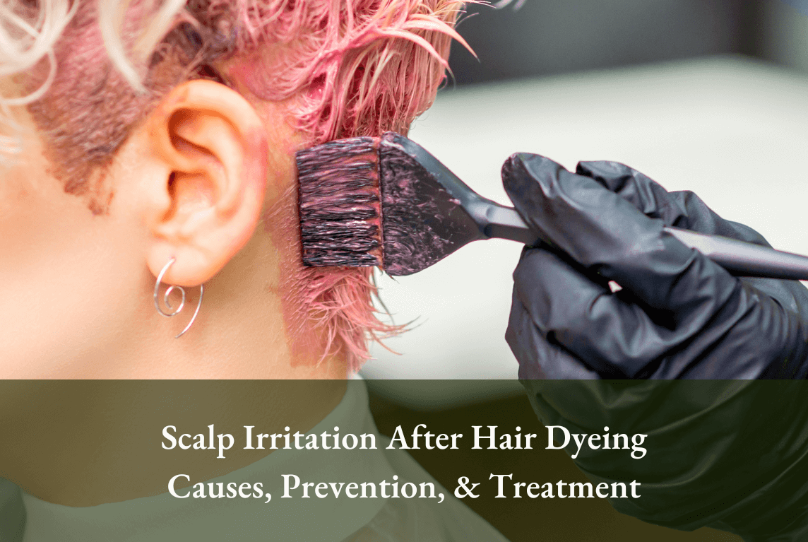 juliArt hairstylist must know_Scalp Irritation After Hair Dyeing Causes, Prevention, and Treatment 2