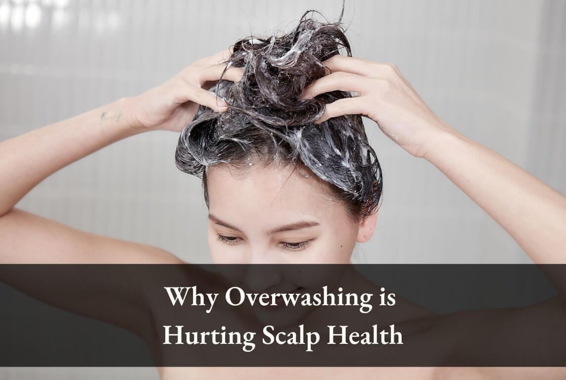 Why Overwashing Is Hurting Client’s Scalp Health?